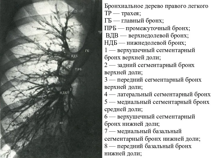 Бронхиальное дерево правого легкого TP — трахея; ГБ — главный бронх; ПРБ —