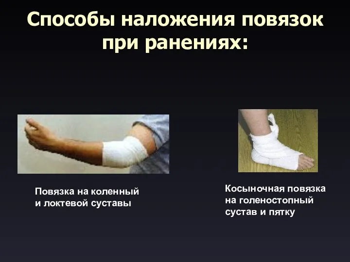 Способы наложения повязок при ранениях: Повязка на коленный и локтевой