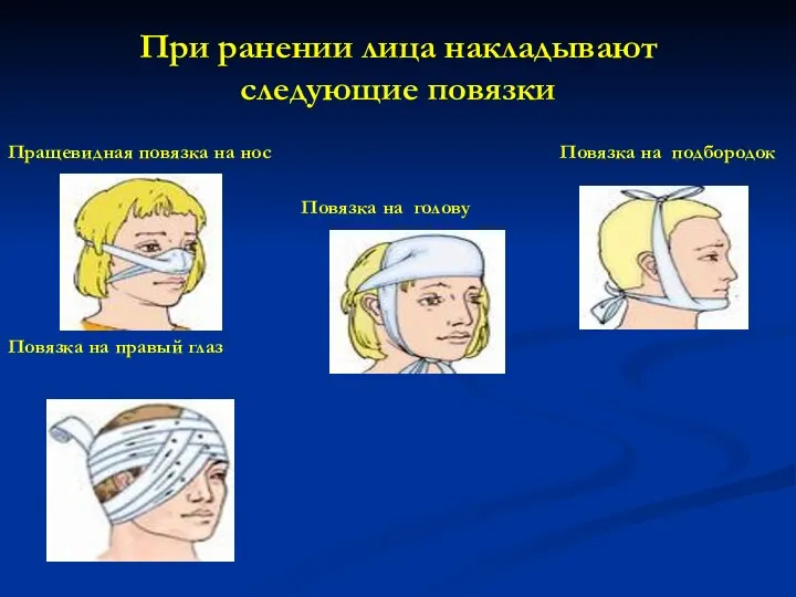 При ранении лица накладывают следующие повязки Пращевидная повязка на нос