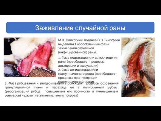 Заживление случайной раны 3. Фаза рубцевания и эпидермизации (происходят процессы созревания грануляционной ткани