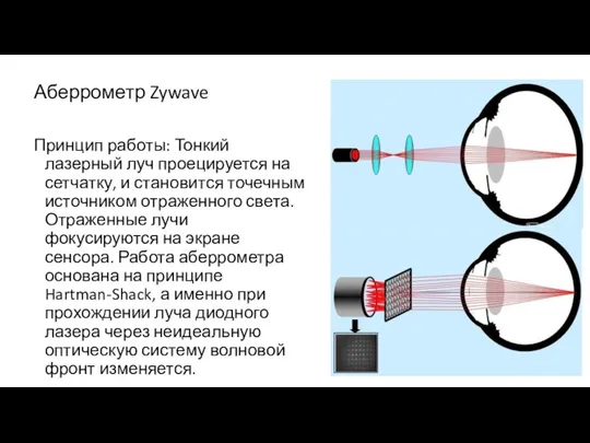 Аберрометр Zywave Принцип работы: Тонкий лазерный луч проецируется на сетчатку,