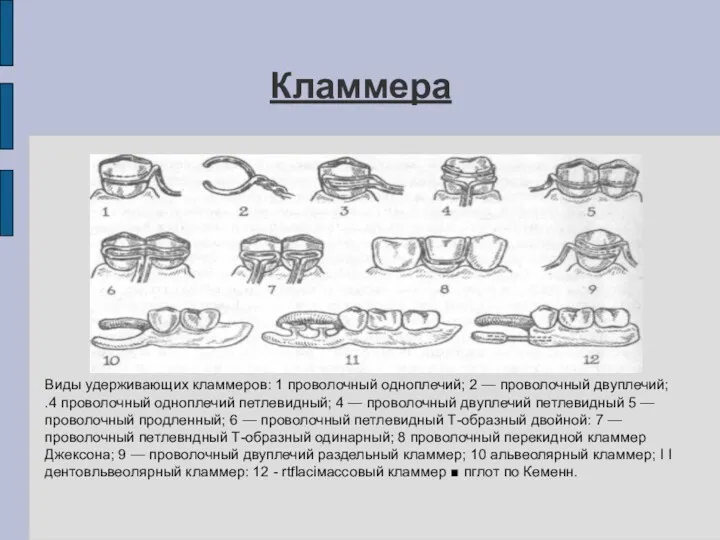 Кламмера Виды удерживающих кламмеров: 1 проволочный одноплечий; 2 — проволочный