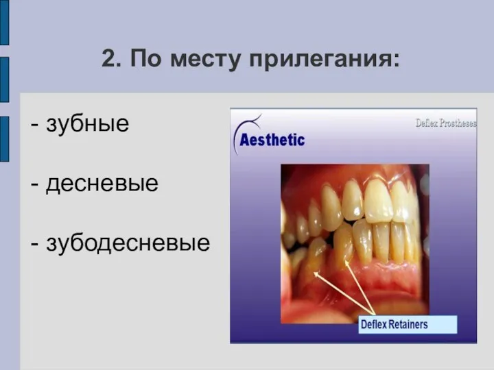 2. По месту прилегания: - зубные - десневые - зубодесневые