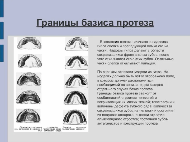 Границы базиса протеза Выведение слепка начинают с надрезов гипса слепка