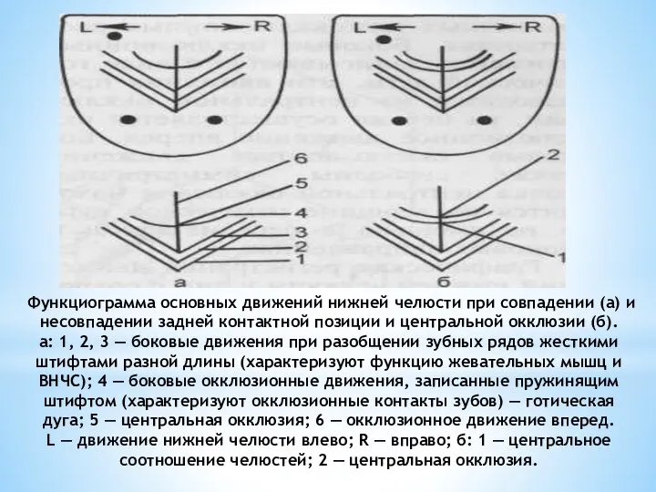 Функциограмма основных движений нижней челюсти при совпа­дении (а) и несовпадении