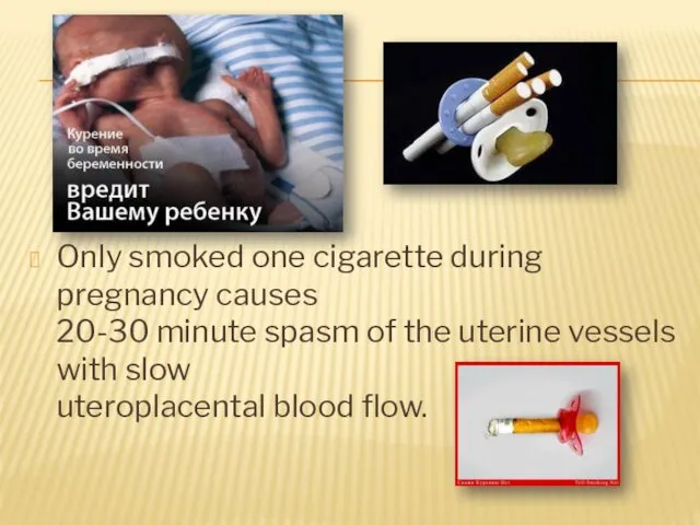 Only smoked one cigarette during pregnancy causes 20-30 minute spasm