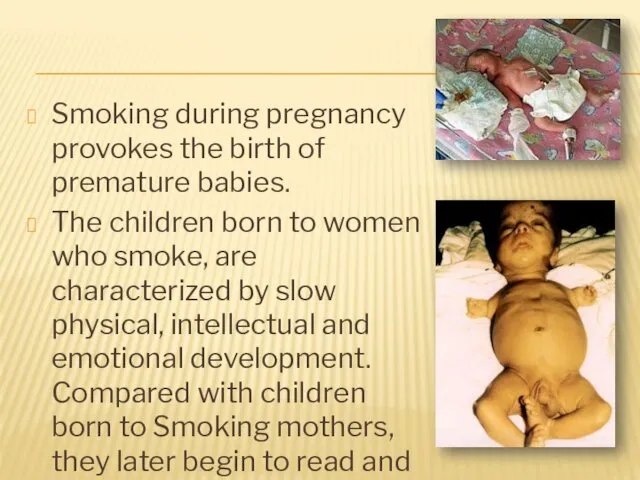 Smoking during pregnancy provokes the birth of premature babies. The