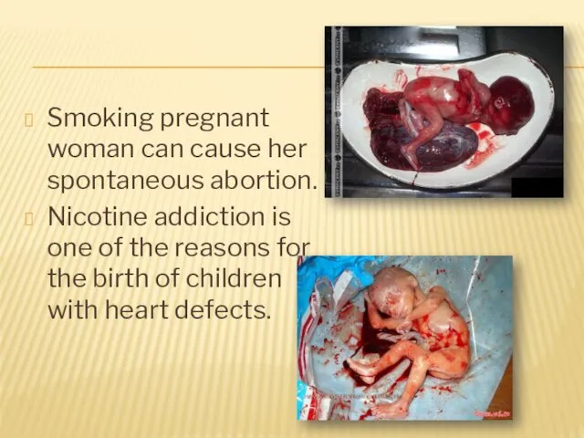 Smoking pregnant woman can cause her spontaneous abortion. Nicotine addiction