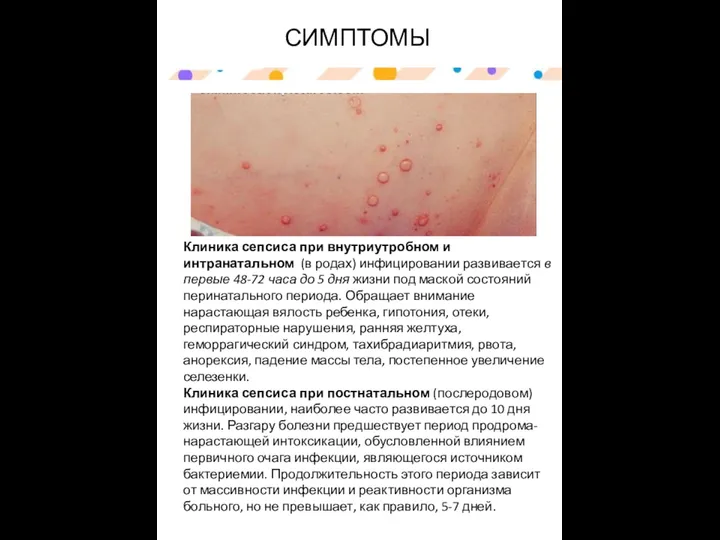 СИМПТОМЫ Клиника сепсиса при внутриутробном и интранатальном (в родах) инфицировании