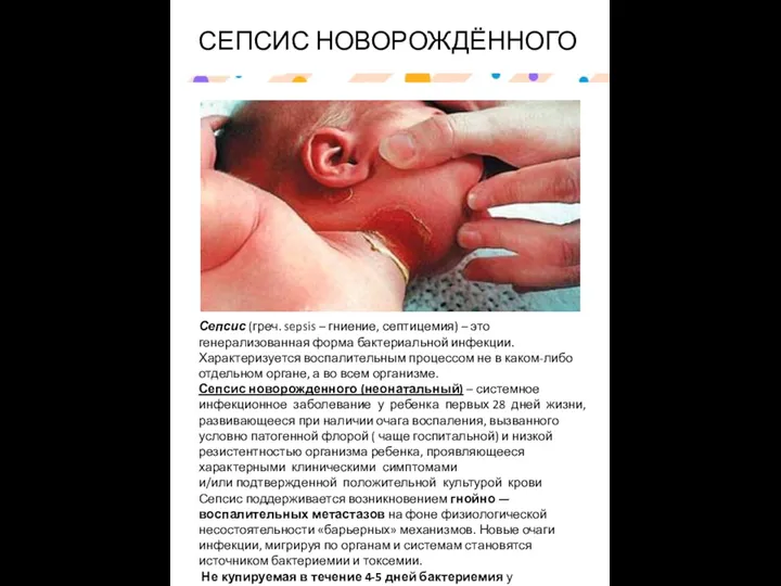 СЕПСИС НОВОРОЖДЁННОГО Сепсис (греч. sepsis – гниение, септицемия) – это