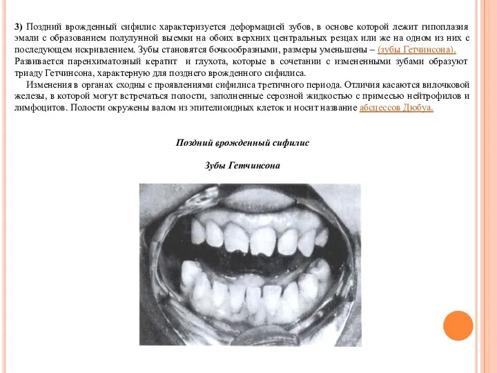 3) Поздний врожденный сифилис характеризуется деформацией зубов, в основе которой