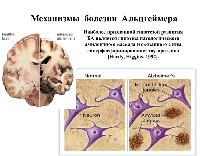 Механизмы болезни Альцгеймера Наиболее признанной гипотезой развития БА является гипотеза патологического амилоидного каскада