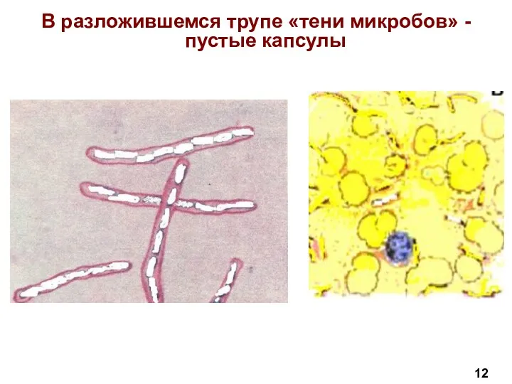 В разложившемся трупе «тени микробов» - пустые капсулы 12