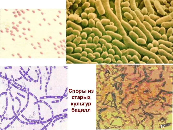 17 Споры из старых культур бацилл