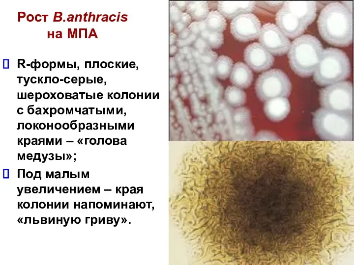 Рост B.anthracis на МПА R-формы, плоские, тускло-серые, шероховатые колонии с