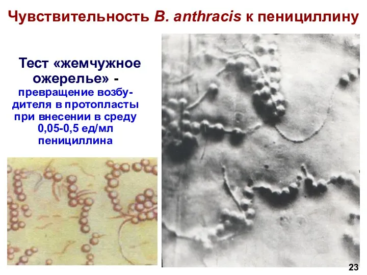 Чувствительность B. anthracis к пенициллину Тест «жемчужное ожерелье» - превращение