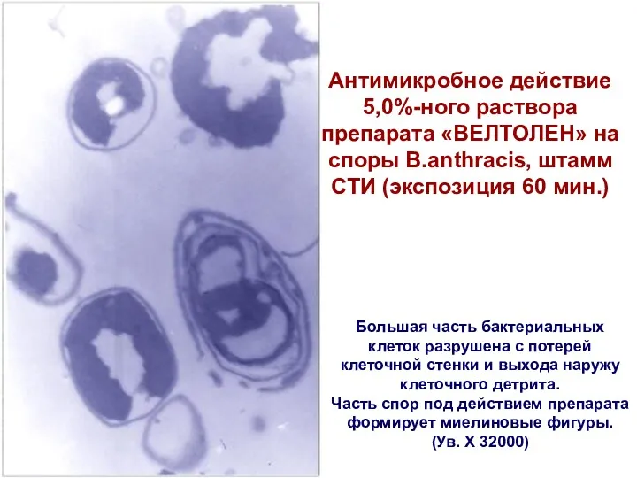 Антимикробное действие 5,0%-ного раствора препарата «ВЕЛТОЛЕН» на споры B.аnthracis, штамм