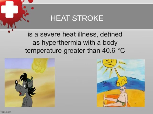 HEAT STROKE is a severe heat illness, defined as hyperthermia