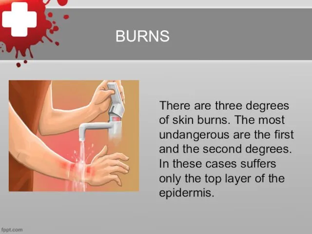 BURNS There are three degrees of skin burns. The most