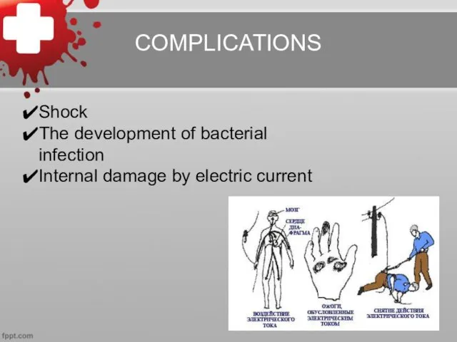 COMPLICATIONS Shock The development of bacterial infection Internal damage by electric current