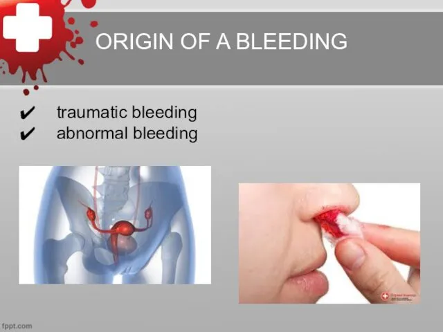 ORIGIN OF A BLEEDING traumatic bleeding abnormal bleeding