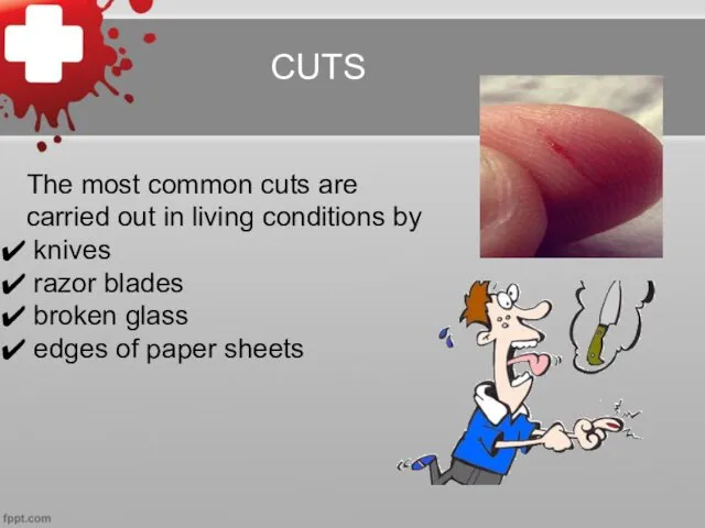 CUTS The most common cuts are carried out in living
