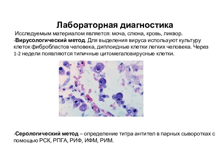 Лабораторная диагностика Исследуемым материалом является: моча, слюна, кровь, ликвор. -Вирусологический