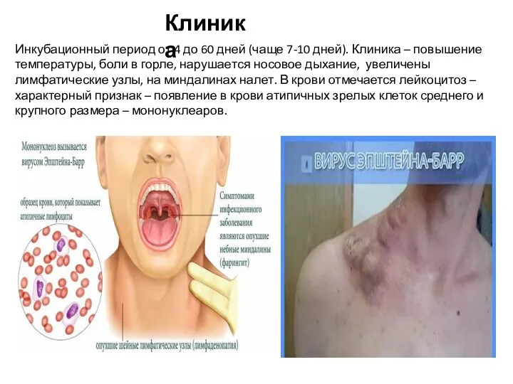 Инкубационный период от 4 до 60 дней (чаще 7-10 дней).