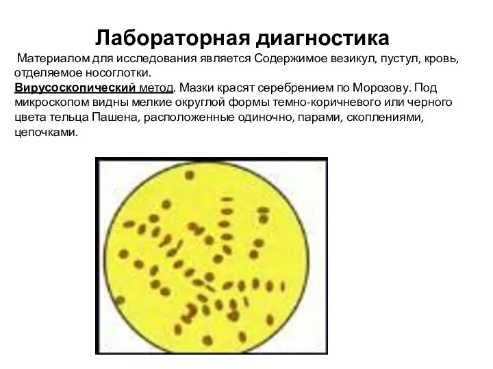 Лабораторная диагностика Материалом для исследования является Содержимое везикул, пустул, кровь,