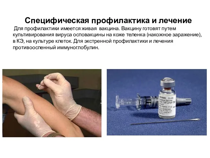Специфическая профилактика и лечение Для профилактики имеется живая вакцина. Вакцину