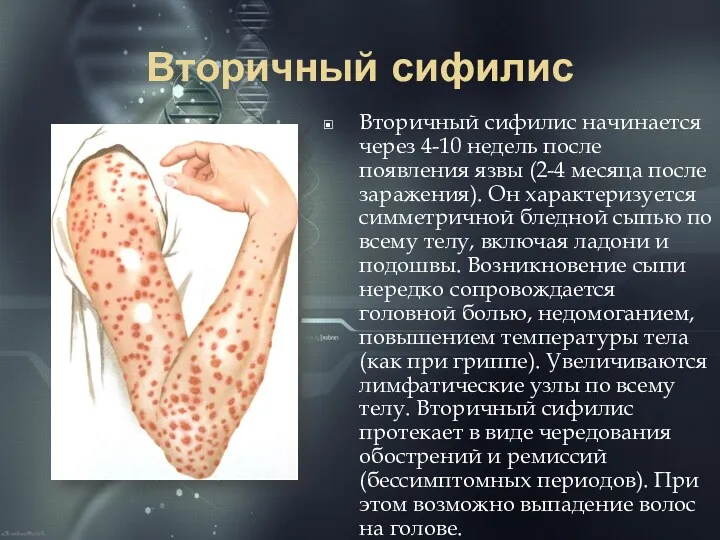 Вторичный сифилис Вторичный сифилис начинается через 4-10 недель после появления