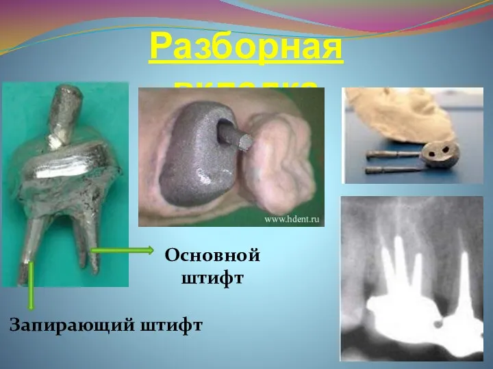 Разборная вкладка Основной штифт Запирающий штифт