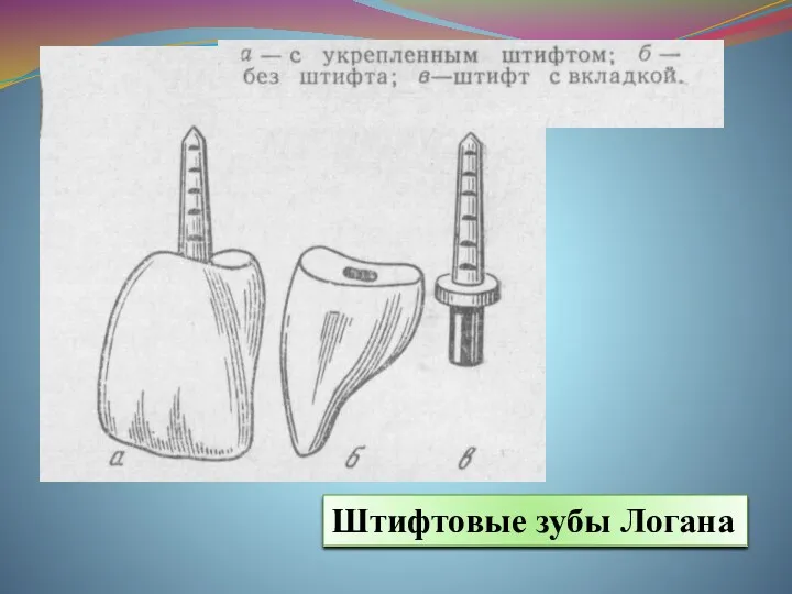 Штифтовые зубы Логана