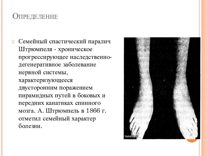 Определение Семейный спастический паралич Штрюмпеля - хроническое прогрессирующее наследственно-дегенеративное заболевание