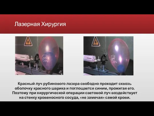 Лазерная Хирургия Красный луч рубинового лазера свободно проходит сквозь оболочку