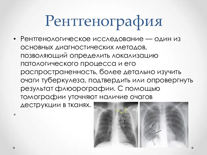Рентгенография Рентгенологическое исследование — один из основных диагностических методов, позволяющий