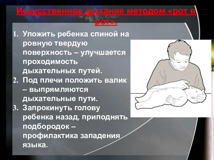 Искусственное дыхание методом «рот в рот». Уложить ребенка спиной на