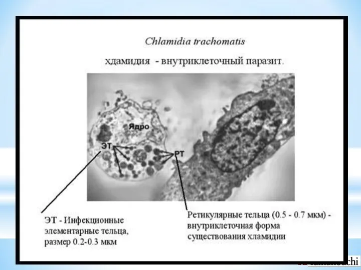 Урогенитальный хламидиоз