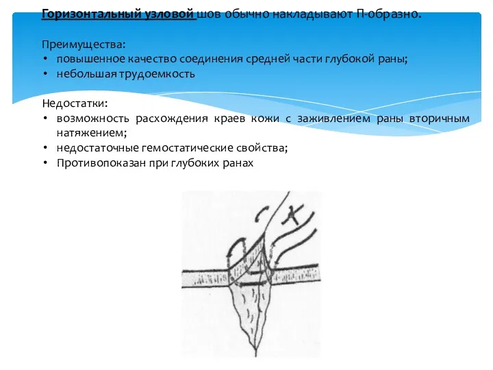 Горизонтальный узловой шов обычно накладывают П-образно. Преимущества: повышенное качество соединения