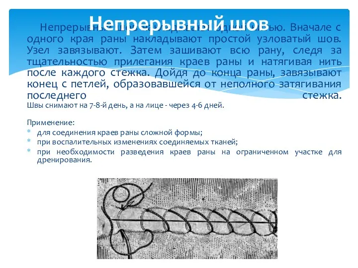 Непрерывный шов накладывают одной нитью. Вначале с одного края раны