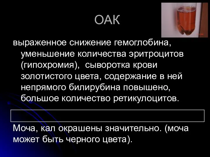 ОАК выраженное снижение гемоглобина, уменьшение количества эритроцитов (гипохромия), сыворотка крови золотистого цвета, содержание