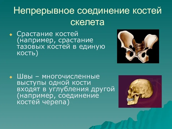 Непрерывное соединение костей скелета Срастание костей (например, срастание тазовых костей
