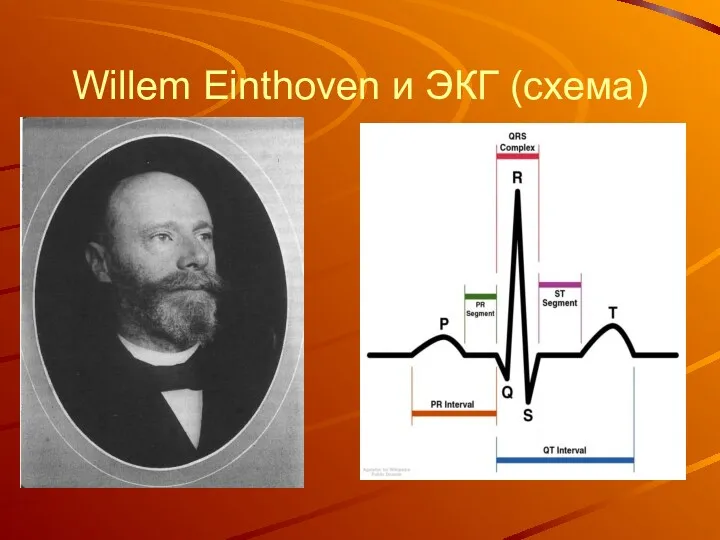 Willem Einthoven и ЭКГ (схема)