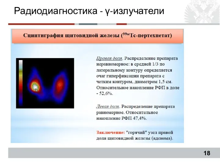 Радиодиагностика - γ-излучатели