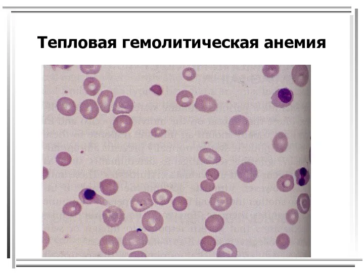 Тепловая гемолитическая анемия