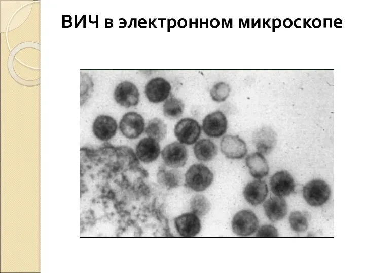 ВИЧ в электронном микроскопе