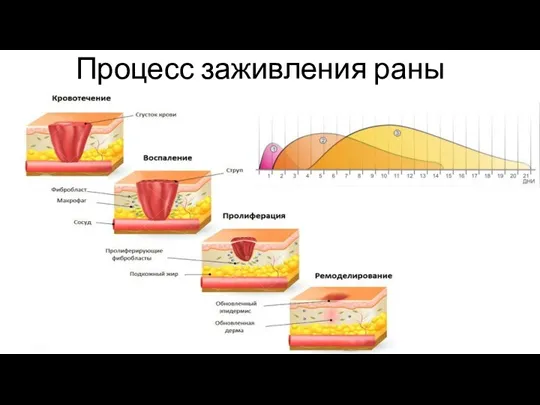 Процесс заживления раны