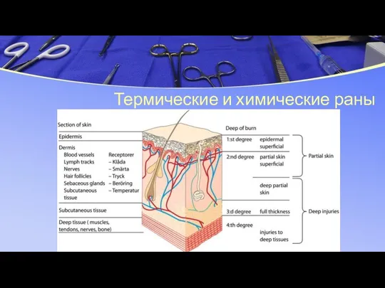 Термические и химические раны