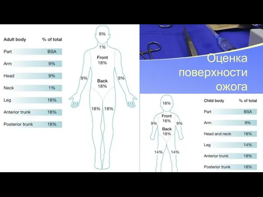 Оценка поверхности ожога