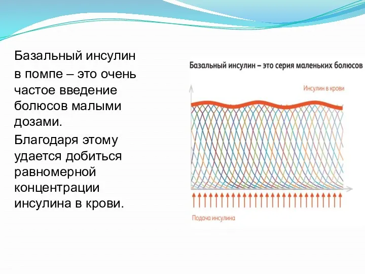 Базальный инсулин в помпе – это очень частое введение болюсов